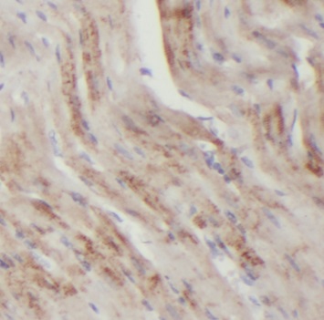ECI2 antibody|ECI2抗体