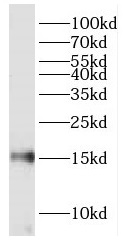FABP7 antibody|FABP7抗体 FNab029