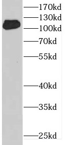 DENND1A antibody|DENND1A抗体