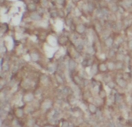 MAP2K4 antibody|MAP2K4抗体 FNab1