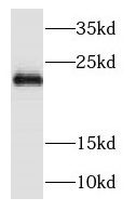 NDUFB9 antibody|NDUFB9抗体