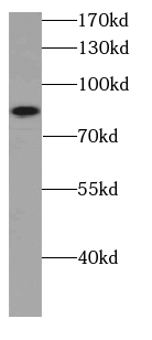 CARNS1 antibody|CARNS1抗体