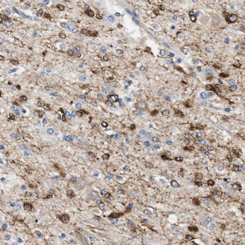PPM1K antibody|PPM1K抗体
