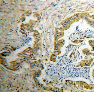 GDI2 antibody|GDI2抗体 FNab03406