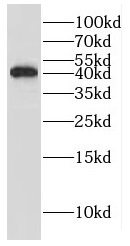 GIPC1 antibody|GIPC1抗体