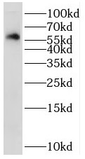 STK32C antibody|STK32C抗体