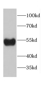 CADM1 antibody|CADM1抗体 FNab011