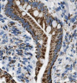 ACCS antibody|ACCS抗体