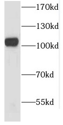 CSE1L antibody|CSE1L抗体