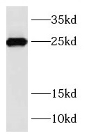 RAB39B antibody|RAB39B抗体