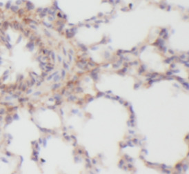 CXCL8 antibody|CXCL8抗体