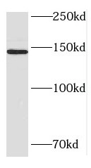 HDLBP antibody|HDLBP抗体