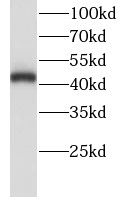 LHX5 antibody|LHX5抗体