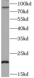 TNFAIP3 antibody|TNFAIP3抗体 FNa