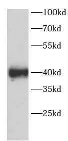 SIRT6 antibody|SIRT6抗体 FNab102