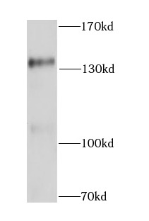 CTCF antibody|CTCF抗体