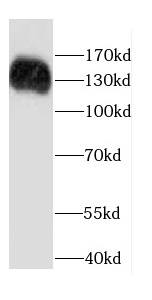 CARD11 antibody|CARD11抗体