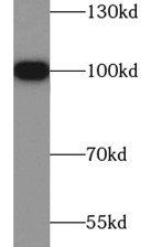 HSP90B1 antibody|HSP90B1抗体 FNa