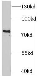 TAB2 antibody|TAB2抗体 FNab08465