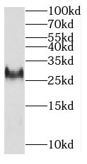 MITD1 antibody|MITD1抗体
