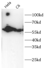 KRT6A antibody|KRT6A抗体 FNab107