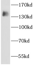 AHI1 antibody|AHI1抗体