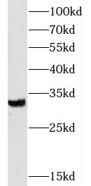SLC25A18 antibody|SLC25A18抗体