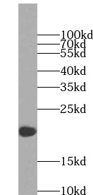 NDUFB8 antibody|NDUFB8抗体