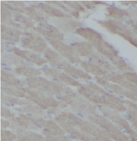 TRADD antibody|TRADD抗体 FNab102