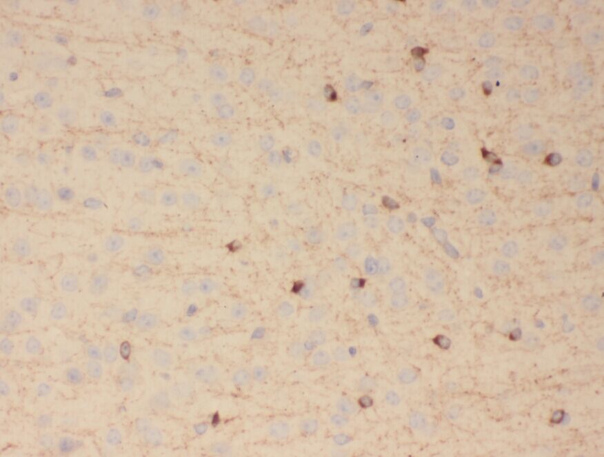 TUT4 antibody|TUT4抗体 FNab09610