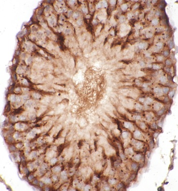 Beta Tubulin antibody|Beta Tub