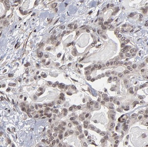 B3GALT4 antibody|B3GALT4抗体