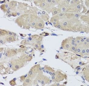 FABP5 antibody|FABP5抗体