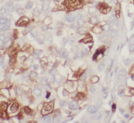 BCL10 antibody|BCL10抗体 FNab008