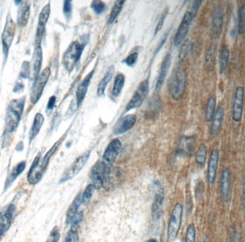 TMPRSS3 antibody|TMPRSS3抗体