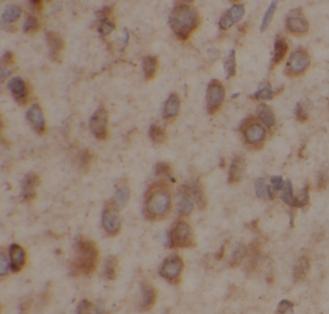 ATP2A2 antibody|ATP2A2抗体 FNab0