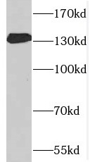 SPARCL1 antibody|SPARCL1抗体