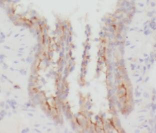 CD206 antibody|CD206抗体 FNab099