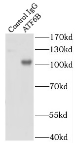 CTNNA2 antibody|CTNNA2抗体