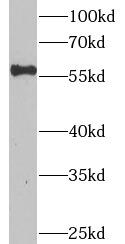 CRHR2 antibody|CRHR2抗体