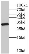 VDAC2 antibody|VDAC2抗体 FNab093