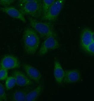 FH antibody|FH抗体 FNab03106