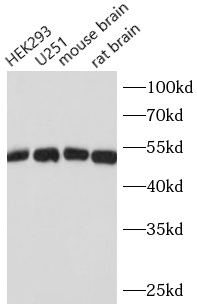 Beta Tubulin antibody|Beta Tub