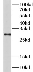 CHMP6 antibody|CHMP6抗体