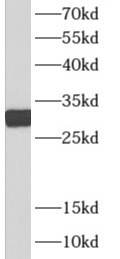 NGF antibody|NGF抗体