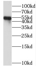 PPP2R5E antibody|PPP2R5E抗体