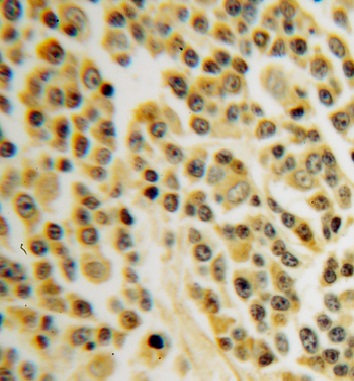 INPP5B antibody|INPP5B抗体