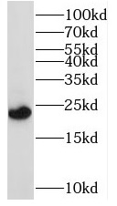 RAB1A antibody|RAB1A抗体