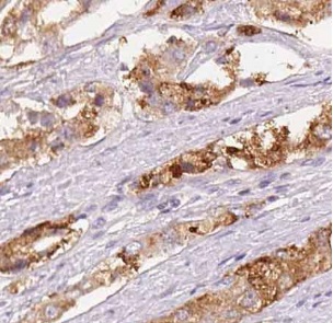 UBE2D3 antibody|UBE2D3抗体