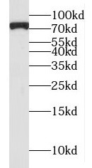 MTA2 antibody|MTA2抗体 FNab05388